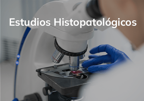 Estudios Histológicos OncoDiagnostic