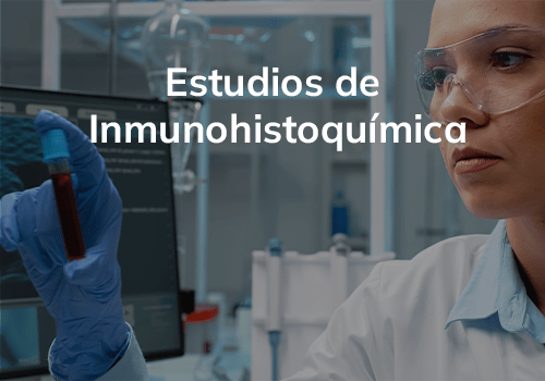 Estudios Inmunohistoquímicos OncoDiagnostic 1